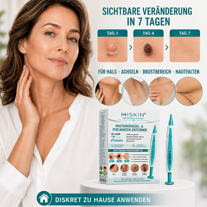 HISKIN® Hautanhängsel- & Stielwarzen-Entferner mit pflanzlicher Pflegeformel – Präzises Mikroring-System für zu Hause