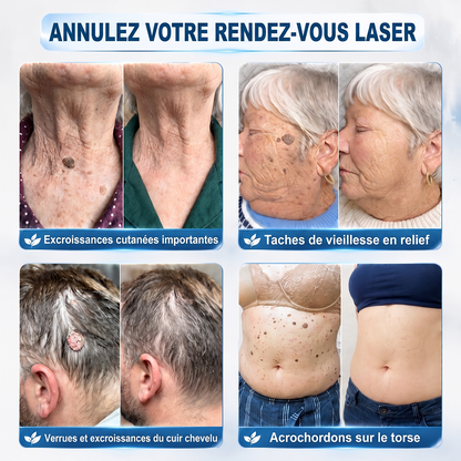 𝐇𝐈𝐒𝐊𝐈𝐍®👩‍⚕️ 𝐄𝐟𝐟𝐚𝐜𝐞𝐮𝐫 𝐝𝐞 𝐒𝐤𝐢𝐧 𝐓𝐚𝐠𝐬 𝐞𝐭 𝐝’𝐈𝐦𝐩𝐞𝐫𝐟𝐞𝐜𝐭𝐢𝐨𝐧𝐬 𝐞𝐧 𝟕 𝐉𝐨𝐮𝐫𝐬 — 𝐒𝐭𝐲𝐥𝐨 𝐑𝐨𝐥𝐥-𝐎𝐧 𝐀𝐯𝐚𝐧𝐜é, 𝐒𝐚𝐧𝐬 𝐃𝐨𝐮𝐥𝐞𝐮𝐫 𝐞𝐭 𝐒𝐚𝐧𝐬 𝐂𝐢𝐜𝐚𝐭𝐫𝐢𝐜𝐞