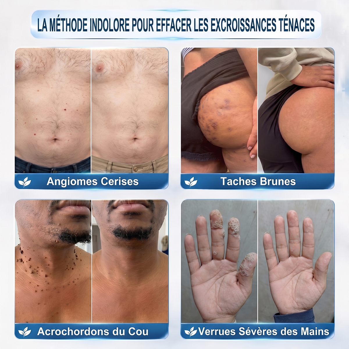 𝐇𝐈𝐒𝐊𝐈𝐍®👩‍⚕️ 𝐄𝐟𝐟𝐚𝐜𝐞𝐮𝐫 𝐝𝐞 𝐒𝐤𝐢𝐧 𝐓𝐚𝐠𝐬 𝐞𝐭 𝐝’𝐈𝐦𝐩𝐞𝐫𝐟𝐞𝐜𝐭𝐢𝐨𝐧𝐬 𝐞𝐧 𝟕 𝐉𝐨𝐮𝐫𝐬 — 𝐒𝐭𝐲𝐥𝐨 𝐑𝐨𝐥𝐥-𝐎𝐧 𝐀𝐯𝐚𝐧𝐜é, 𝐒𝐚𝐧𝐬 𝐃𝐨𝐮𝐥𝐞𝐮𝐫 𝐞𝐭 𝐒𝐚𝐧𝐬 𝐂𝐢𝐜𝐚𝐭𝐫𝐢𝐜𝐞