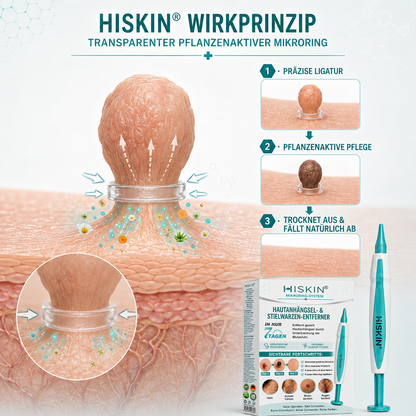 HISKIN® Hautanhängsel- & Stielwarzen-Entferner mit pflanzlicher Pflegeformel – Präzises Mikroring-System für zu Hause