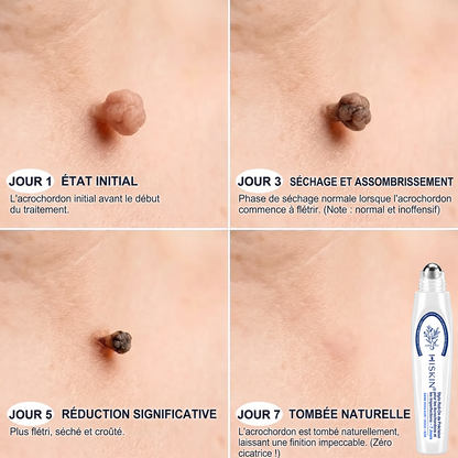 𝐇𝐈𝐒𝐊𝐈𝐍®👩‍⚕️ 𝐄𝐟𝐟𝐚𝐜𝐞𝐮𝐫 𝐝𝐞 𝐒𝐤𝐢𝐧 𝐓𝐚𝐠𝐬 𝐞𝐭 𝐝’𝐈𝐦𝐩𝐞𝐫𝐟𝐞𝐜𝐭𝐢𝐨𝐧𝐬 𝐞𝐧 𝟕 𝐉𝐨𝐮𝐫𝐬 — 𝐒𝐭𝐲𝐥𝐨 𝐑𝐨𝐥𝐥-𝐎𝐧 𝐀𝐯𝐚𝐧𝐜é, 𝐒𝐚𝐧𝐬 𝐃𝐨𝐮𝐥𝐞𝐮𝐫 𝐞𝐭 𝐒𝐚𝐧𝐬 𝐂𝐢𝐜𝐚𝐭𝐫𝐢𝐜𝐞