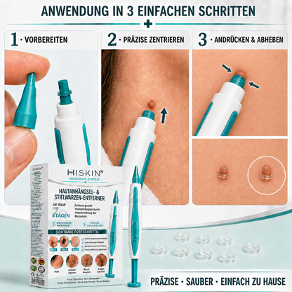 HISKIN® Hautanhängsel- & Stielwarzen-Entferner mit pflanzlicher Pflegeformel – Präzises Mikroring-System für zu Hause